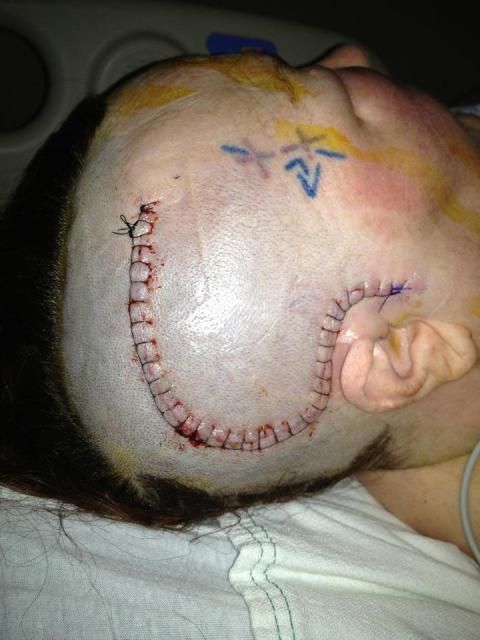 they let me come home last night..warning pics of my ouchie - Goats