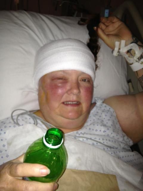 they let me come home last night..warning pics of my ouchie - Goats